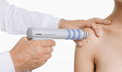 Extracorporeal Shockwave Therapy